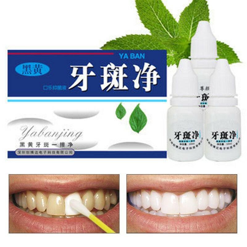Yabanjing Teeth Whitening/Dental Bleaching Essence 